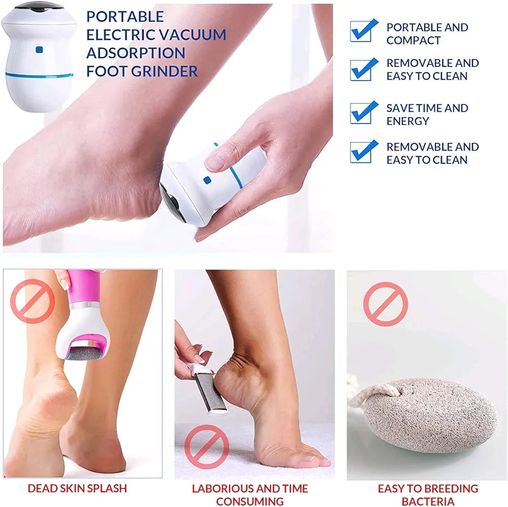 Rechargeable Callus remover