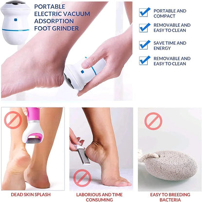 Rechargeable Callus remover