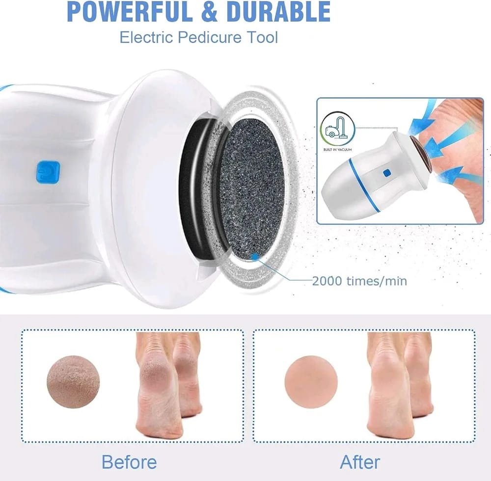 Rechargeable Callus remover