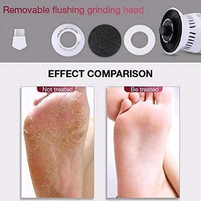 Rechargeable Callus remover