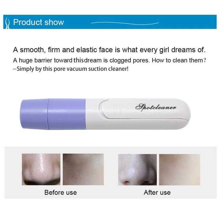 Blackhead remover - MASTER SUPPLIES